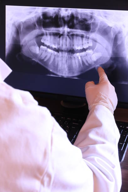 Best Dental Abscess Treatment in Rusk, TX